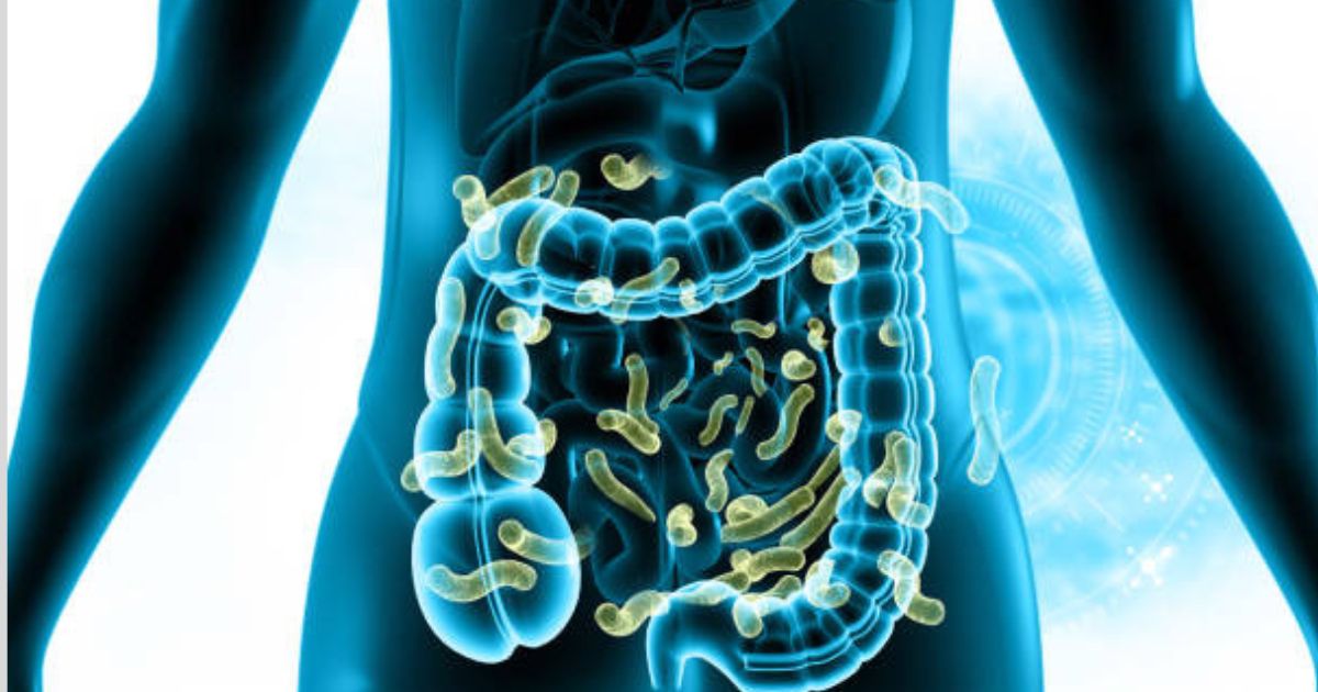 Top 10 Gut Healthy Condiments to Support Better Digestion Naturally